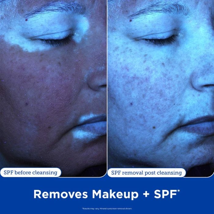 Skinfix-Barrier-Gentle-Gel-Cleanser4 Na obrazku znajduje się porównanie dwóch zdjęć twarzy tej samej osoby przed i po oczyszczeniu skóry przy użyciu produktu Skinfix Barrier+ Ceramide + Ectoin Gentle Gel Cleanser. Oba zdjęcia zostały wykonane w świetle UV, aby uwidocznić obecność i usunięcie filtra przeciwsłonecznego (SPF). Zdjęcie po lewej stronie oznaczone "SPF before cleansing" przedstawia twarz osoby przed oczyszczeniem. Skóra jest pokryta filtrem przeciwsłonecznym, co jest widoczne jako jasne obszary na zdjęciu. Zdjęcie po prawej stronie oznaczone "SPF removal post cleansing" pokazuje twarz osoby po oczyszczeniu. Skóra jest wyraźnie oczyszczona z filtra przeciwsłonecznego, co wskazuje na skuteczność produktu w usuwaniu SPF. Na dole obrazka znajduje się napis "Removes Makeup + SPF" oraz mały dopisek "*Results may vary. Mineral sunscreen removal shown." Tekst podkreśla, że produkt skutecznie usuwa zarówno makijaż, jak i filtry przeciwsłoneczne.