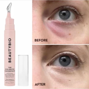 Produkt BeautyBio The Eyelighter Concentrate wraz z aplikatorem i widocznym efektem przed i po użyciu. Górna część obrazu pokazuje oko z wyraźnymi cieniami i opuchlizną ("Before"), a dolna część przedstawia to samo oko po zastosowaniu serum, z widocznie zmniejszonymi cieniami i opuchlizną ("After"). Produkt w różowym opakowaniu jest widoczny po lewej stronie zdjęcia.