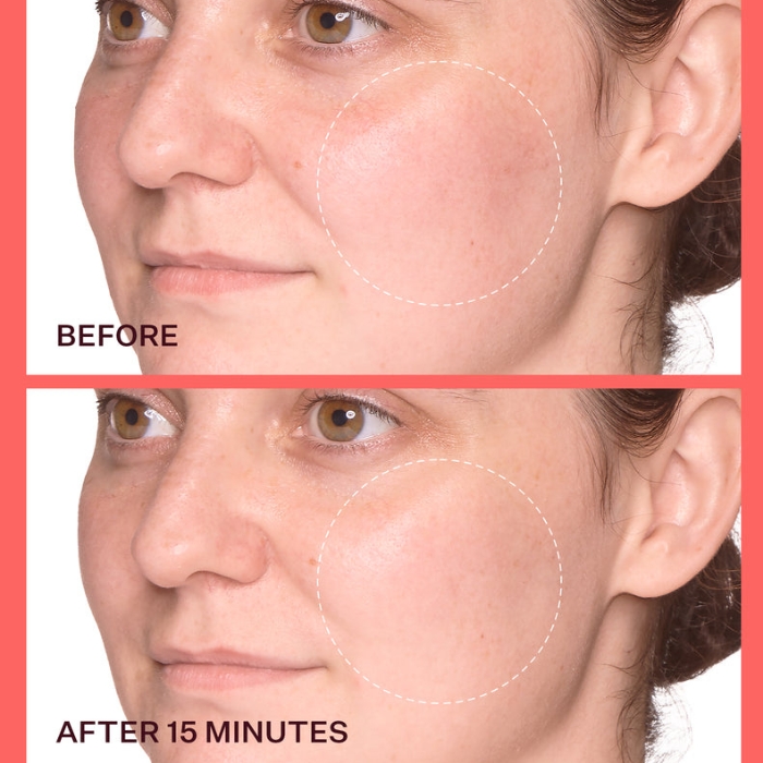 Peach Lily Cryo Reset Calming Mask Pads Porównanie efektów przed i po użyciu płatków Cryo Reset. Zdjęcie pokazuje skórę przed aplikacją oraz po 15 minutach – widoczna jest redukcja zaczerwienień oraz bardziej nawilżona i rozświetlona skóra.