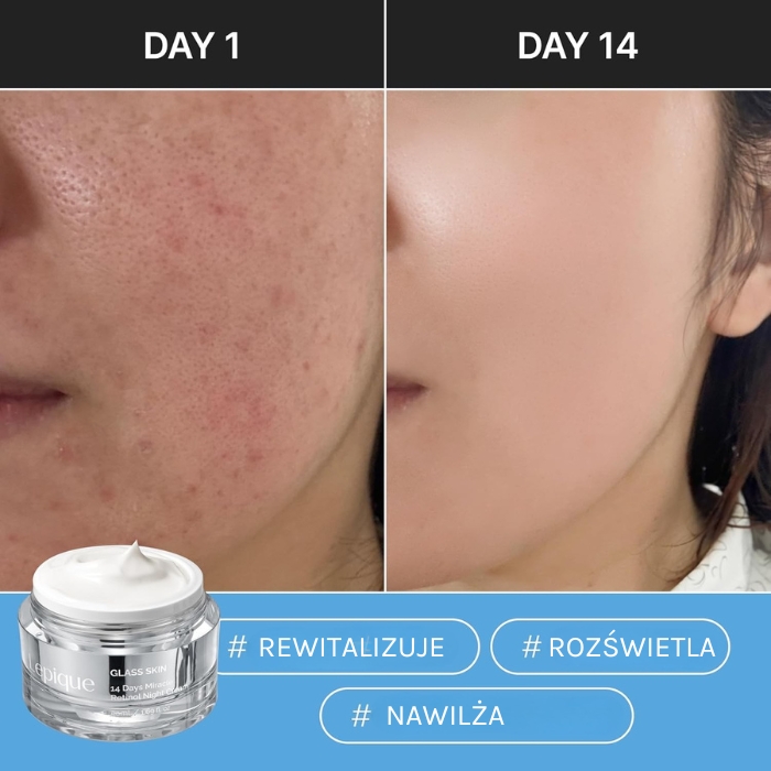 Lepique Glass Skin Retinol Night Cream djęcie przedstawia skórę twarzy z efektami przed i po zastosowaniu kremu Lepique Glass Skin Retinol Night Cream .
