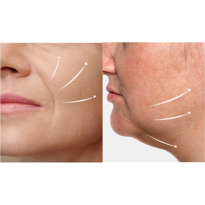 Avajar Rejuvenating Double V Mask 2 Przedstawienie efektów działania maski modelującej Rejuvenating Double V Mask marki Avajar