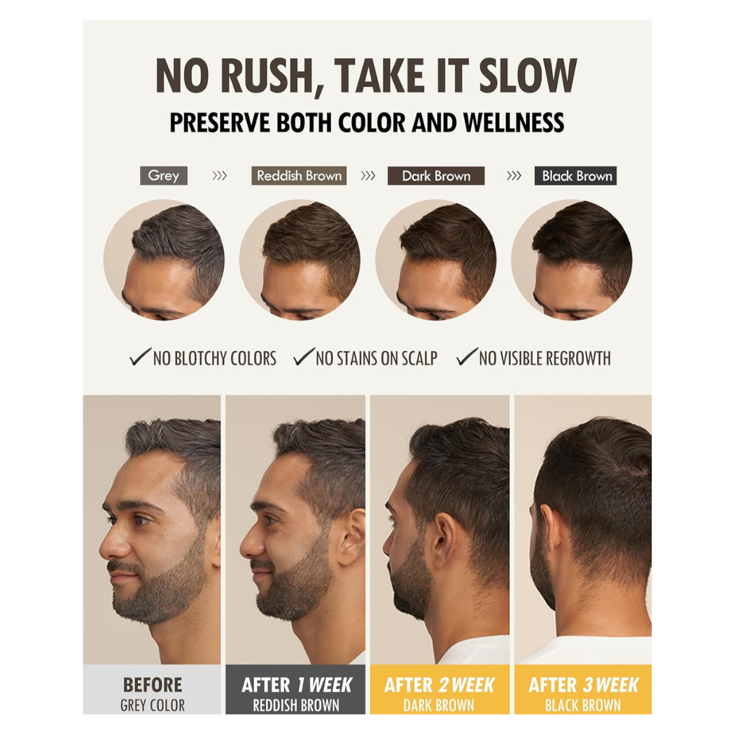 Modamoda Black Shampoo 10 Zero Grey Grafika z efektem stosowania szamponu MODA MODA: stopniowa zmiana koloru włosów od siwych do ciemnego brązu. Widać zdjęcia profilu mężczyzny „Before” (siwe włosy), „After 1 week” (rudy-brązowy odcień), „After 2 weeks” (ciemny brąz) oraz „After 3 weeks” (czarno-brązowy). Na górze hasła: „No rush, take it slow” oraz „Preserve both color and wellness”, a pod zdjęciami zalety – brak plam na włosach, brak przebarwień skóry głowy, brak widocznych odrostów.