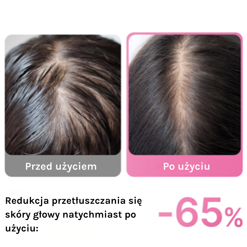 Medicube Rosemary PDRN Cooling Thickening Shampoo Efekt przed i po stosowaniu Medicube Rosemary PDRN Shampoo – redukcja przetłuszczania skóry głowy o 65%