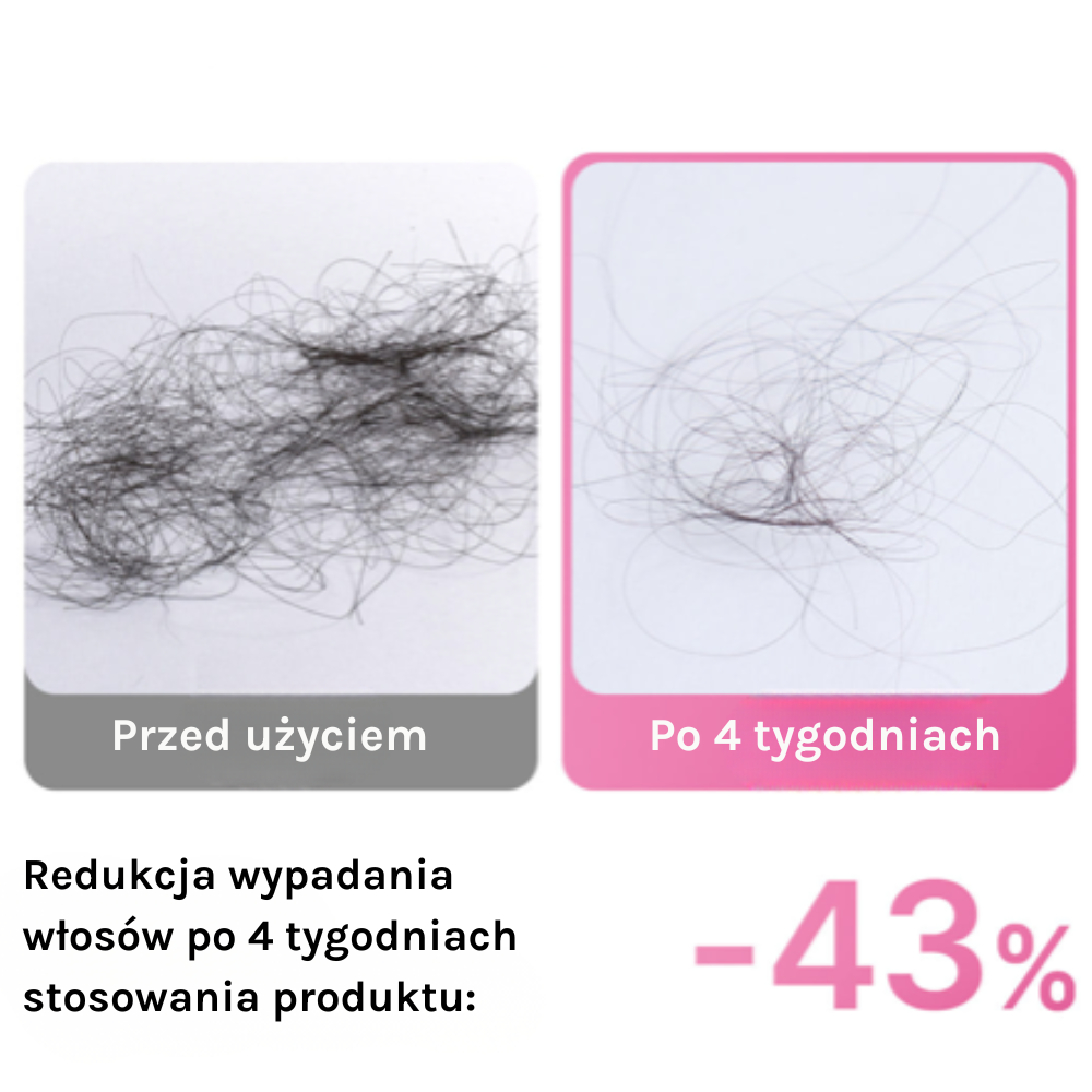 Medicube Rosemary PDRN Cooling Thickening Shampoo Medicube Rosemary PDRN – porównanie przed i po 4 tygodniach, zmniejszenie wypadania włosów o 43%