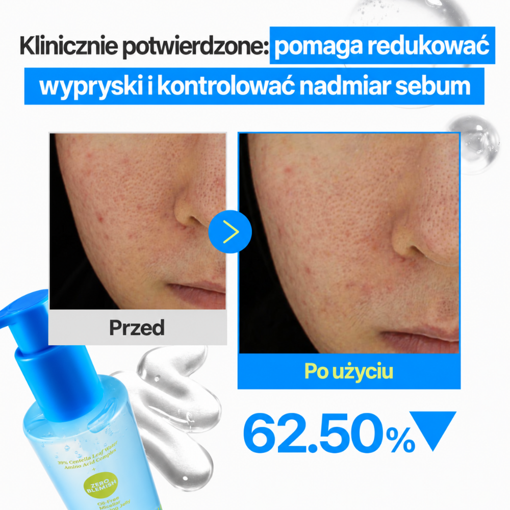 Numbuzin Zero Blemish Oil-Free Micellar Cleansing Jelly Grafika przed i po przedstawiająca wygląd skóry po użyciu żelu Numbuzin Zero Blemish oraz deklarowaną redukcję niedoskonałości i nadmiaru sebum o 62,5%.