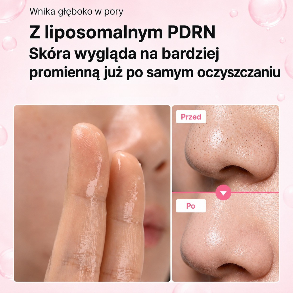 Medicube PDRN Mild Cleansing Oil Medicube PDRN Mild Cleansing Oil – grafika przedstawiająca oczyszczanie skóry i wygląd porów przed oraz po zastosowaniu olejku z liposomalnym PDRN.