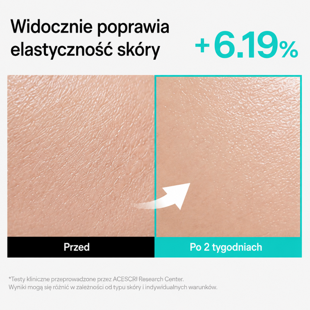 Thome PPM 50,000 Triple Synergy Rejuvenating Cream - nocny tryb komfortu (11) Widok porównawczy skóry przed stosowaniem produktu i po 2 tygodniach, przedstawiający poprawę elastyczności skóry o 6,19% na podstawie wyników badań klinicznych.