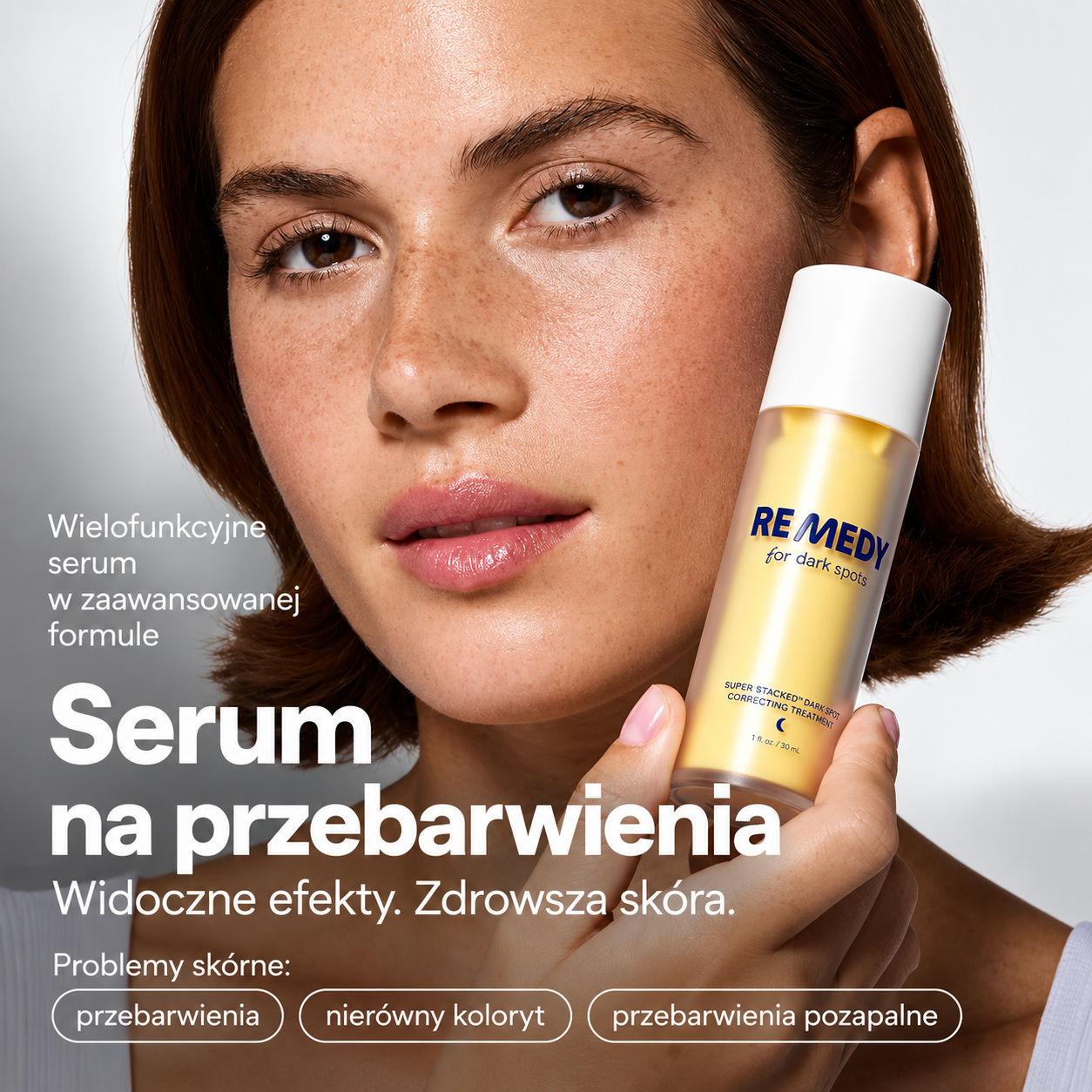 3 Remedy Science REMEDY for Dark Spots - serum na przebarwienia prezentowane przy twarzy modelki, przeznaczone do pielęgnacji nierównego kolorytu, przebarwień i śladów pozapalnych.