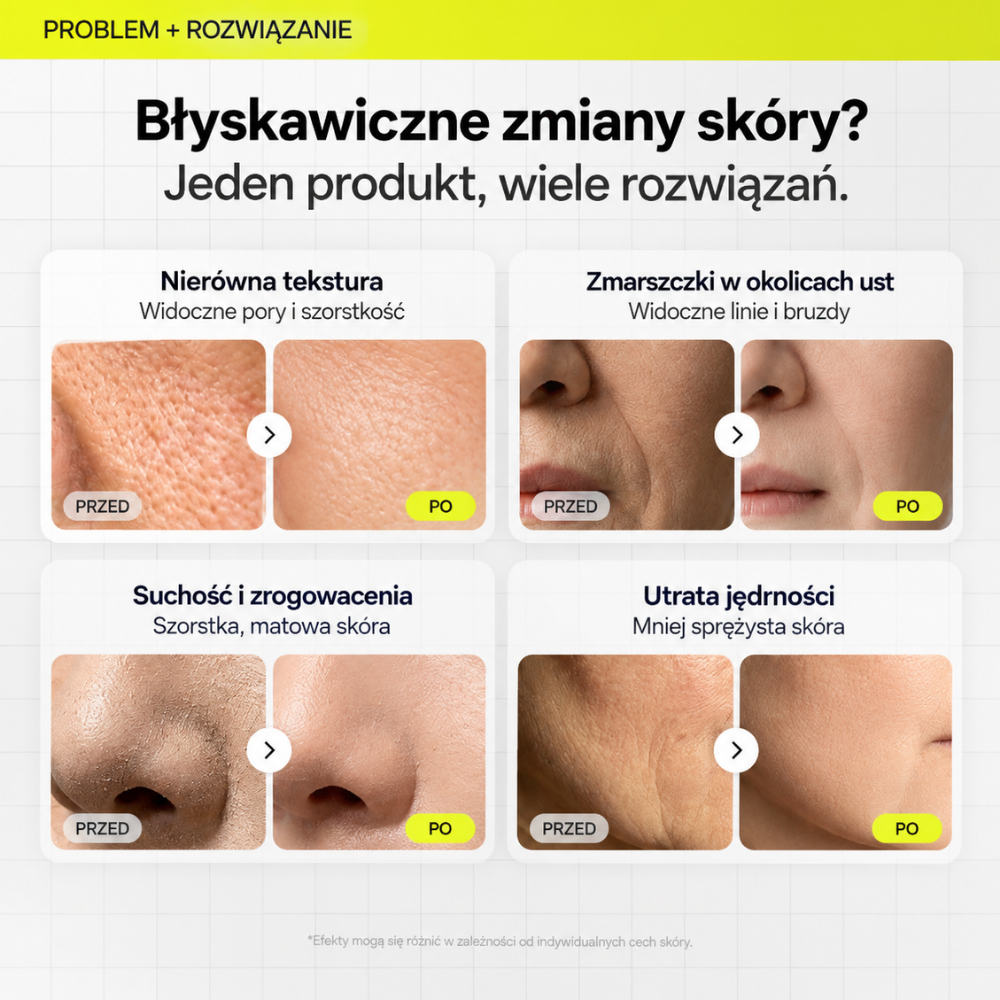 Celimax Retinal Shot Tightening Dual Cream - efekt nowej skóry (4) Celimax Retinal Shot Tightening Dual Cream - grafika przed i po pokazująca poprawę wyglądu porów i tekstury skóry, suchości, zmarszczek w okolicach ust oraz utraty jędrności.