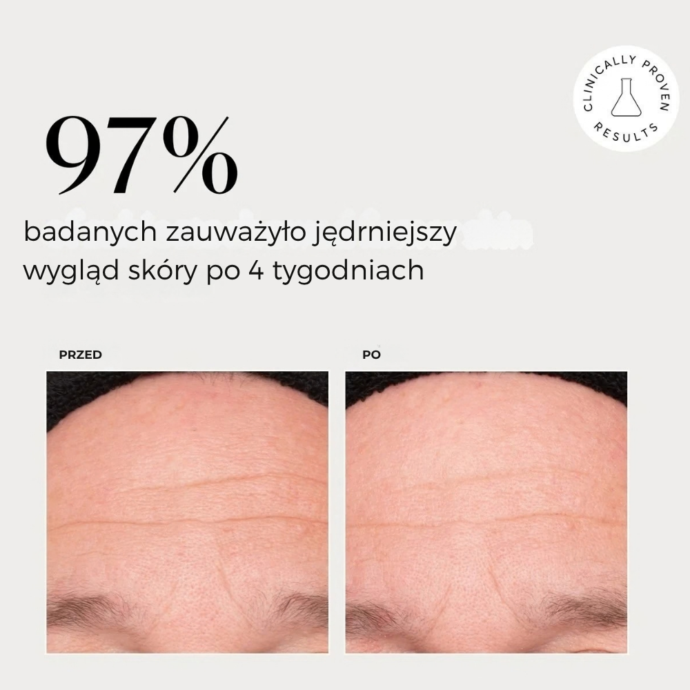 Naturium Multi Peptide Advanced Serum (4) Naturium Multi-Peptide Advanced Serum - rezultaty badania klinicznego przed i po, pokazujące jędrniejszy wygląd skóry po 4 tygodniach u 97% badanych.