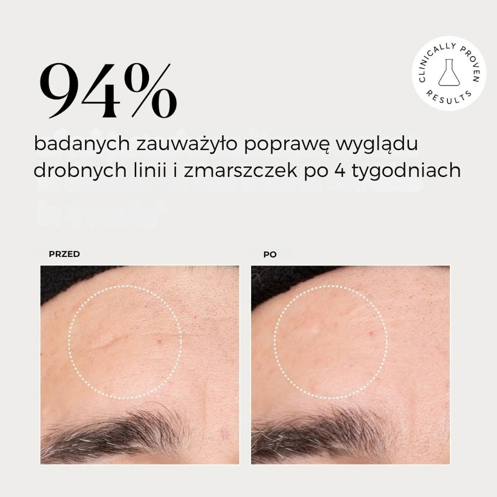Naturium Multi Peptide Advanced Serum (5) Naturium Multi-Peptide Advanced Serum - rezultaty badania klinicznego przed i po, pokazujące poprawę wyglądu drobnych linii i zmarszczek po 4 tygodniach u 94% badanych.