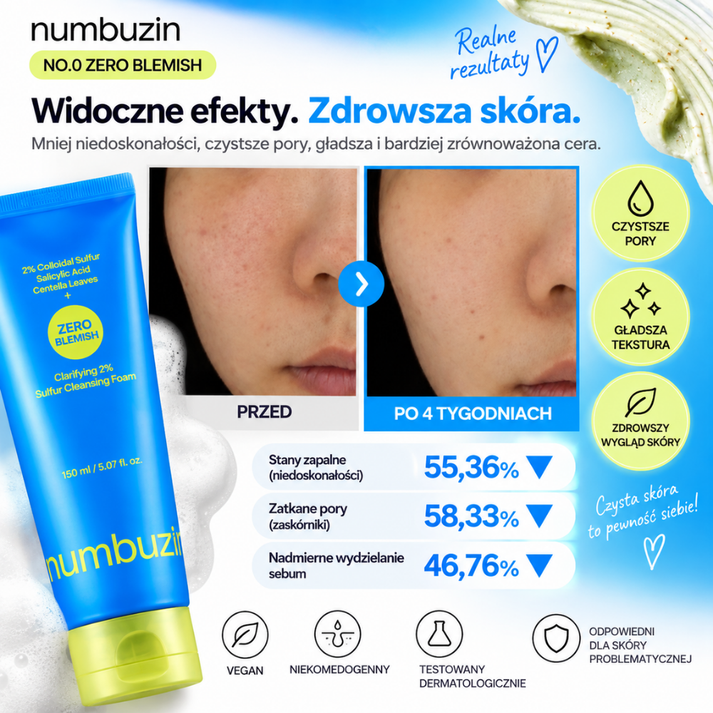 Numbuzin Zero Blemish Clarifying Cleansing Foam - oczyszczająca pianka z siarką (3) Numbuzin No.0 Zero Blemish - grafika efektów stosowania po 4 tygodniach, przedstawiająca zmniejszenie niedoskonałości, zatkanych porów i nadmiernego wydzielania sebum.