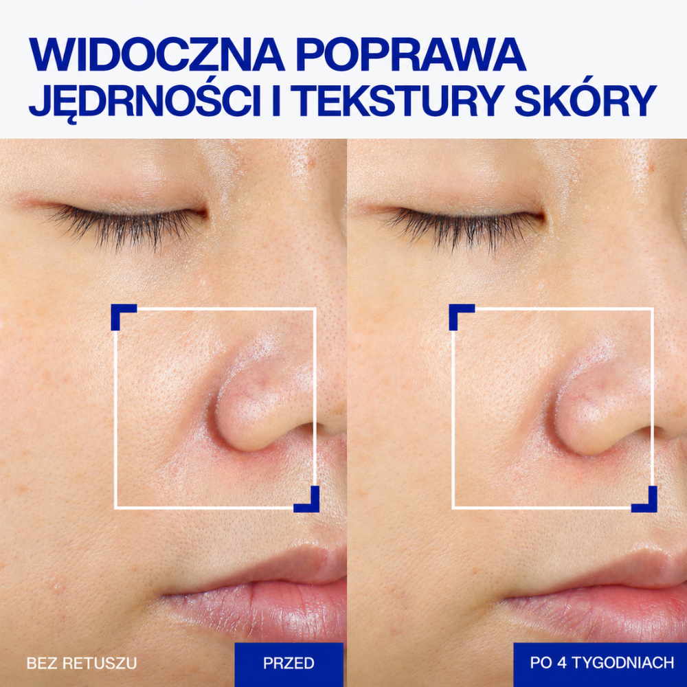Iope XMD Stem Clinical Recovery Serum - Efekt Skin Boostera Bez Igły (4) Grafika 3 - przed i po: Efekty stosowania IOPE XMD Stem III Clinical Recovery Serum - porównanie skóry przed i po 4 tygodniach, pokazujące poprawę wyglądu jędrności i tekstury skóry oraz widoczności porów.