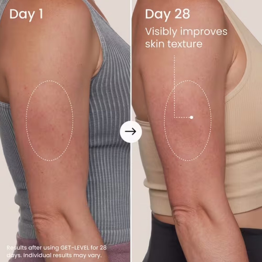 Maelys Get Level Keratosis Pilaris Body Scrub (4) MAËLYS GET-LEVEL Keratosis Pilaris Body Scrub - zdjęcie porównawcze przed i po 28 dniach stosowania peelingu do ciała. Zbliżenie na ramiona kobiety przedstawia widoczną poprawę wyglądu nierównej tekstury skóry oraz drobnych grudek związanych z rogowaceniem okołomieszkowym.