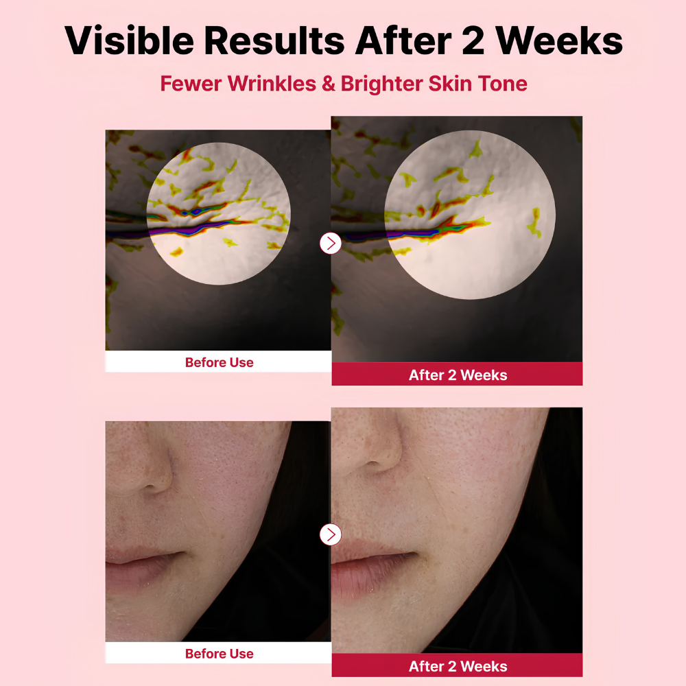 NIDA Yam Mucin ABCE Serum (5) NIDA Yam Mucin ABCE Serum - efekty przed i po 2 tygodniach stosowania koreańskiego serum z retinalem i roślinną mucyną. Grafika porównawcza przedstawia deklarowane przez producenta wygładzenie drobnych zmarszczek, poprawę tekstury skóry oraz rozświetlenie i wyrównanie kolorytu cery.