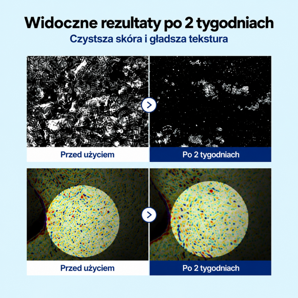 Nida AHA BHA Clarity Toner - tonik z kwasami na pory i efekt glass skin (4) NIDA AHA BHA Clarity Toner - tonik złuszczający na czyste pory i efekt gładkiej skóry. Grafika porównawcza przed i po dwóch tygodniach stosowania przedstawia obrazy skóry ilustrujące zmniejszenie nagromadzenia zanieczyszczeń i poprawę wyglądu tekstury skóry.