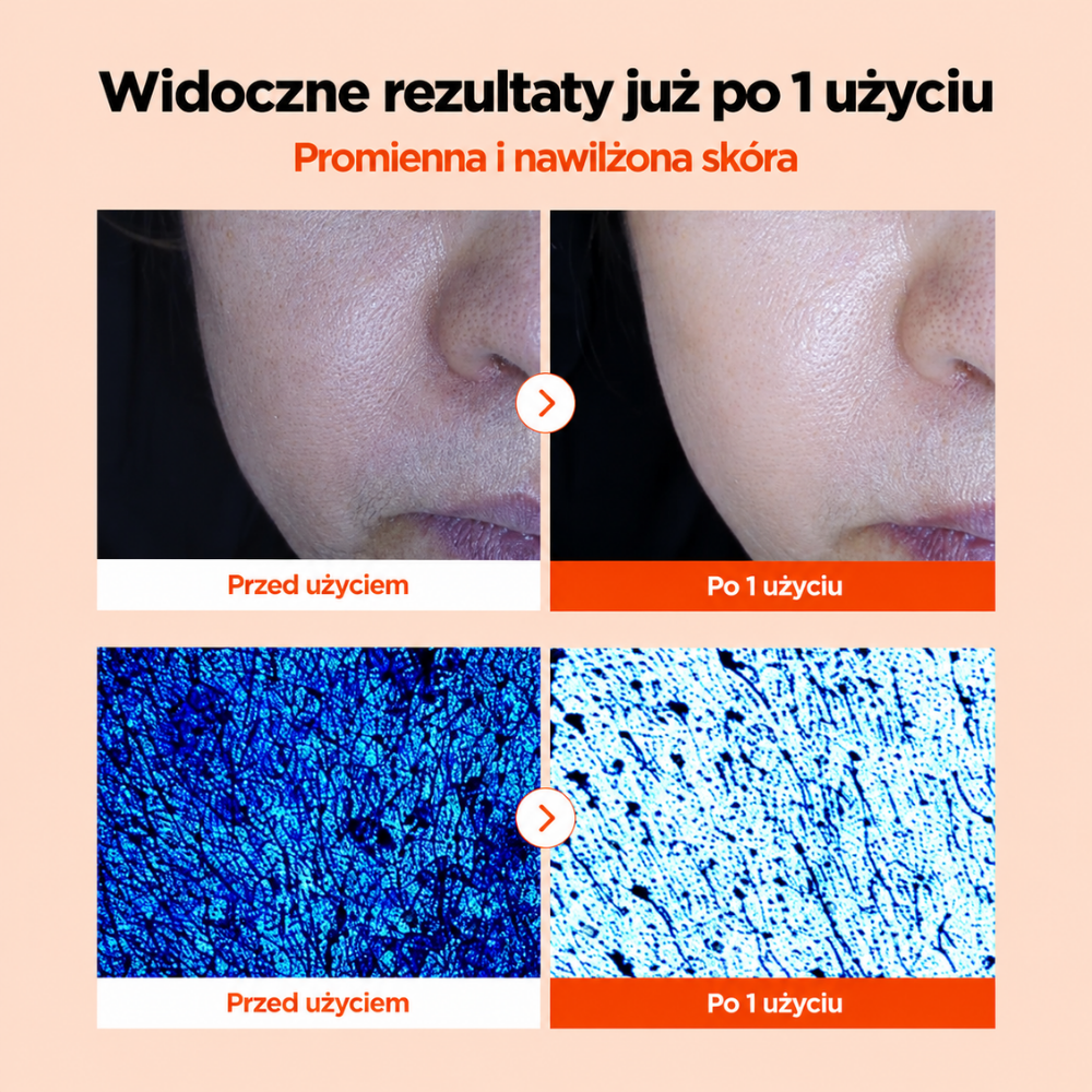 Nida Salmon PDRN Peptide Serum - gładka i promienna cera bez zmarszczek (4) NIDA Salmon PDRN Peptide Serum - koreańskie serum do pielęgnacji skóry suchej, zmęczonej i pozbawionej blasku. Grafika porównawcza przed i po jednym użyciu przedstawia zbliżenia skóry twarzy oraz obrazy jej powierzchni ilustrujące poprawę nawilżenia i promienności.