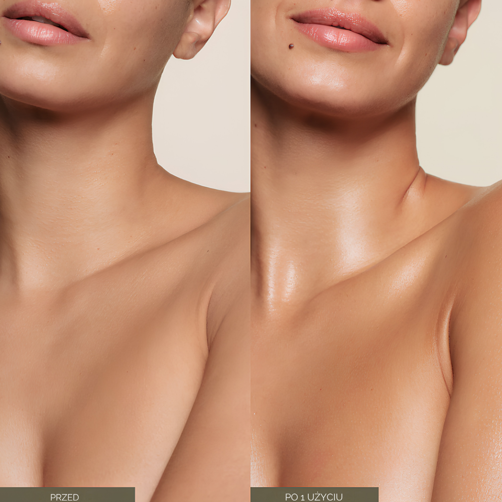 Oak Essentials Dew Body Oil Efekt przed i po 1 użyciu Oak Essentials Dew Body Oil - skóra dekoltu po aplikacji olejku wygląda na bardziej gładką, nawilżoną i pełną naturalnego blasku.