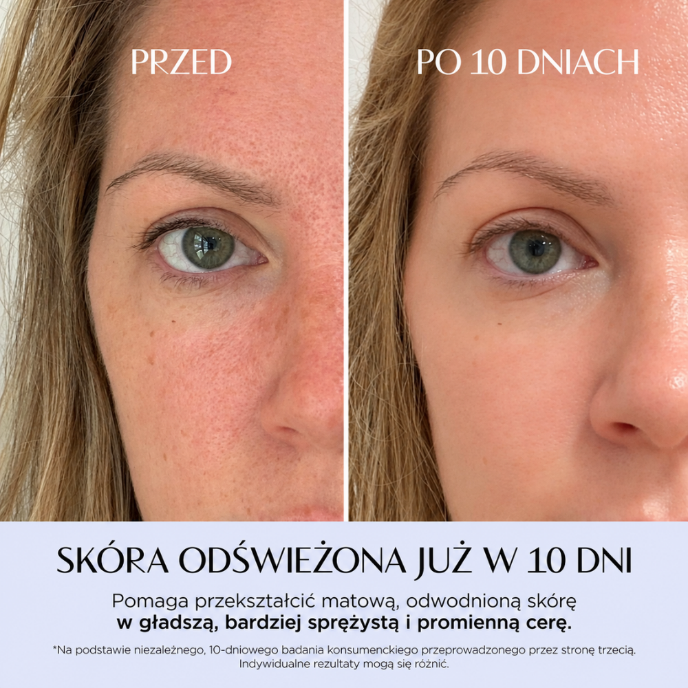 Olivia Umma PDRN Skin Toning Mist - różowy reset dla spragnionej skóry (3) Olivia Umma PDRN Skin Toning Mist – porównanie wyglądu skóry przed i po 10 dniach stosowania mgiełki. Grafika przedstawia zbliżenie twarzy kobiety, ukazując gładszą, bardziej nawilżoną i promienną cerę oraz mniej widoczne zaczerwienienia.