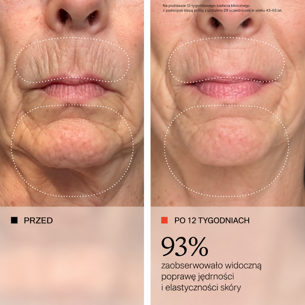 OneSkin OS 01 Face Rich Cream - długowieczność twojej skóry zaczyna się tutaj (5) OneSkin OS-01 Face Rich Cream - efekt przed i po 12 tygodniach - porównanie skóry przed i po 12 tygodniach stosowania kremu; 93% badanych zaobserwowało widoczną poprawę jędrności i elastyczności skóry.
