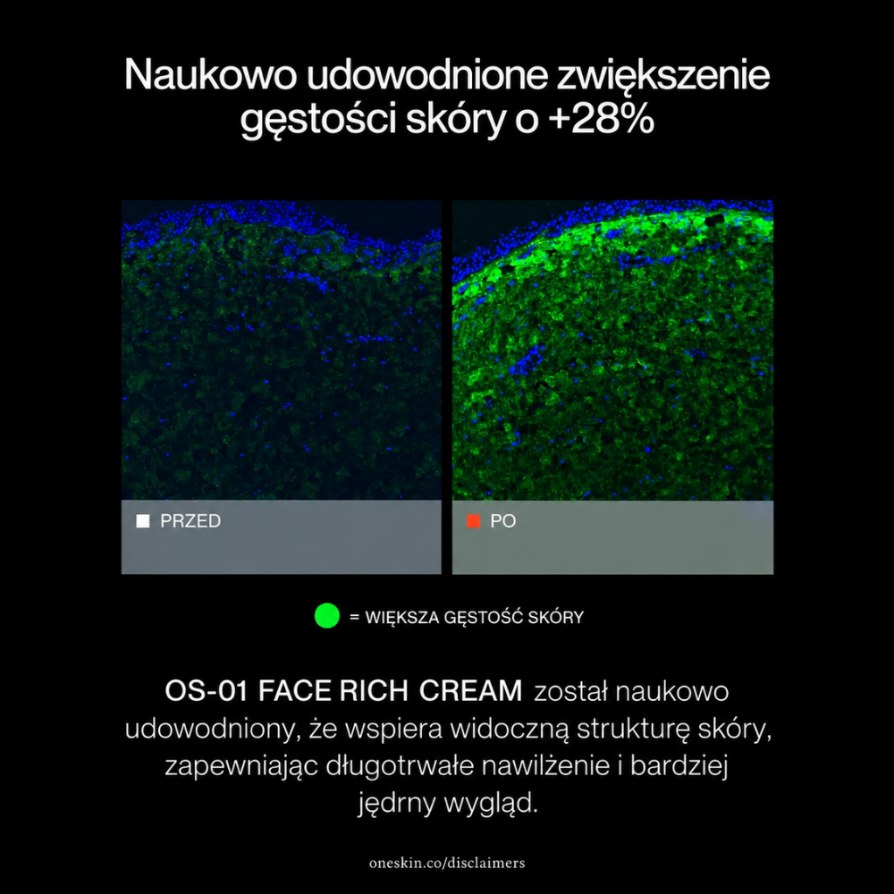 OneSkin OS 01 Face Rich Cream - długowieczność twojej skóry zaczyna się tutaj (6) OneSkin OS-01 Face Rich Cream - wzrost gęstości skóry o 28% - grafika z obrazami porównawczymi przed i po, przedstawiająca naukowo potwierdzone zwiększenie gęstości skóry o 28% oraz wsparcie jej widocznej struktury.