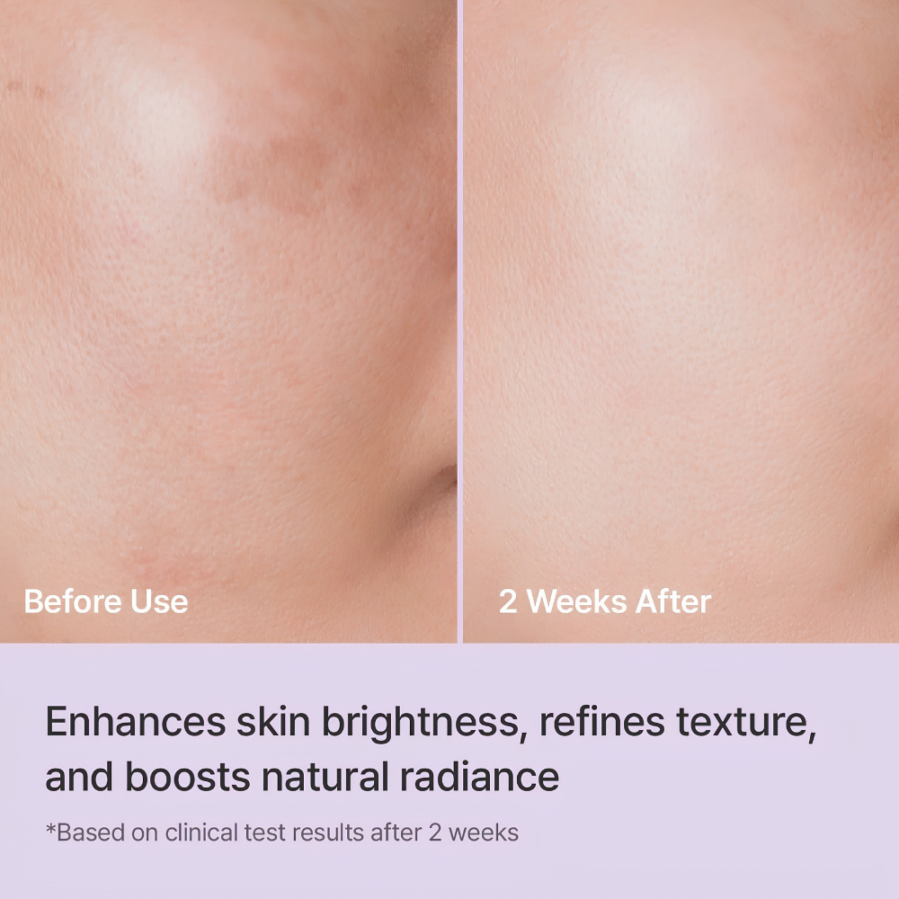 Rejuran Healer Triple Radiance Ampoule C PDRN 0.5% (7) REJURAN Healer Triple Radiance Ampoule c-PDRN 0.5% - porównanie skóry przed i po 2 tygodniach stosowania ampułki, przedstawiające poprawę wyglądu kolorytu, wygładzenie tekstury i naturalne rozświetlenie cery.