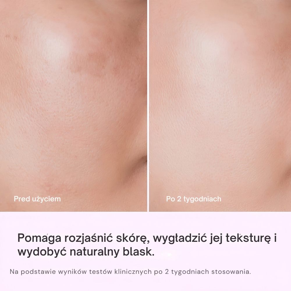 Rejuran Triple Radiance Ampoule c PDRN 0.5% (5) REJURAN Triple Radiance Ampoule c-PDRN 0,5% - porównanie skóry przed użyciem i po 2 tygodniach stosowania, pokazujące bardziej rozświetlony, gładki i wyrównany wygląd cery.